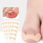 Korektor na zarostlé nehty – nálepky pro péči o nohy